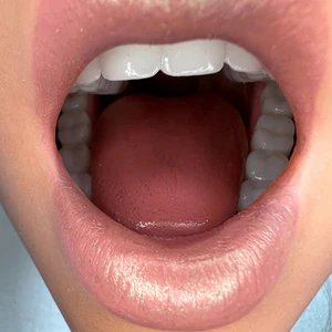 MOUTH TYPE - Image 2