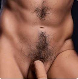SELECT IMPLANTED HAIR/S: - Image 2