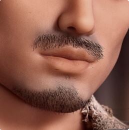 SELECT IMPLANTED HAIR/S: - Image 2